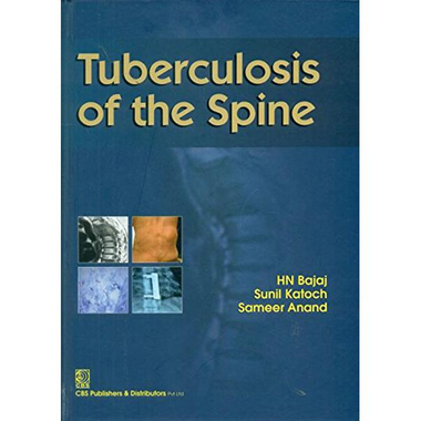 Tuberculosis of the Spine