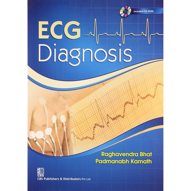 ECG Diagnosis