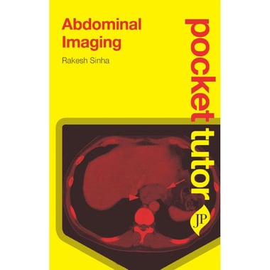 Abdominal Imaging (Pocket Tutor)