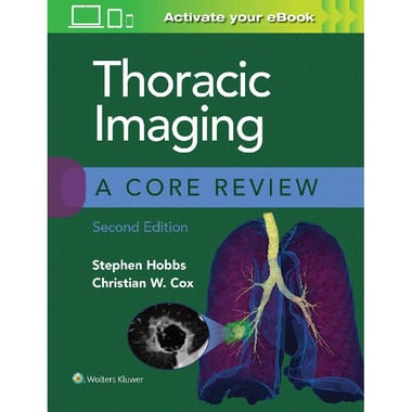Thoracic Imaging, a Core Review, 2nd Edition