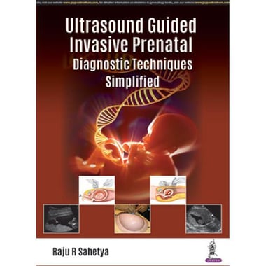 Ultrasound Guided Invasive Prenatal - Diagnostic Techniques Simplified
