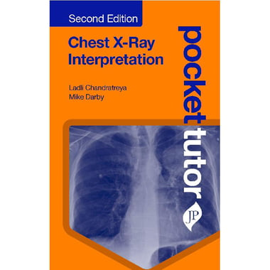 Pocket Tutor Chest X-Ray Interpretation, 2nd Edition (Pocket Tutor Series)